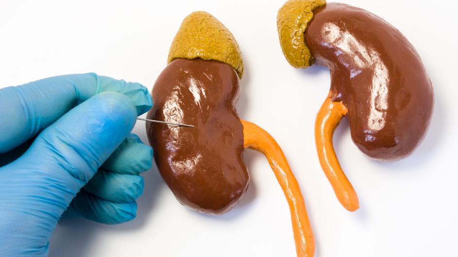 Kidney biopsy